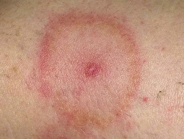 Бобруйчанка просит наказать врачей, которые месяцами не могли поставить ей диагноз Бобруйчанка просит наказать врачей, которые месяцами не могли поставить ей диагноз