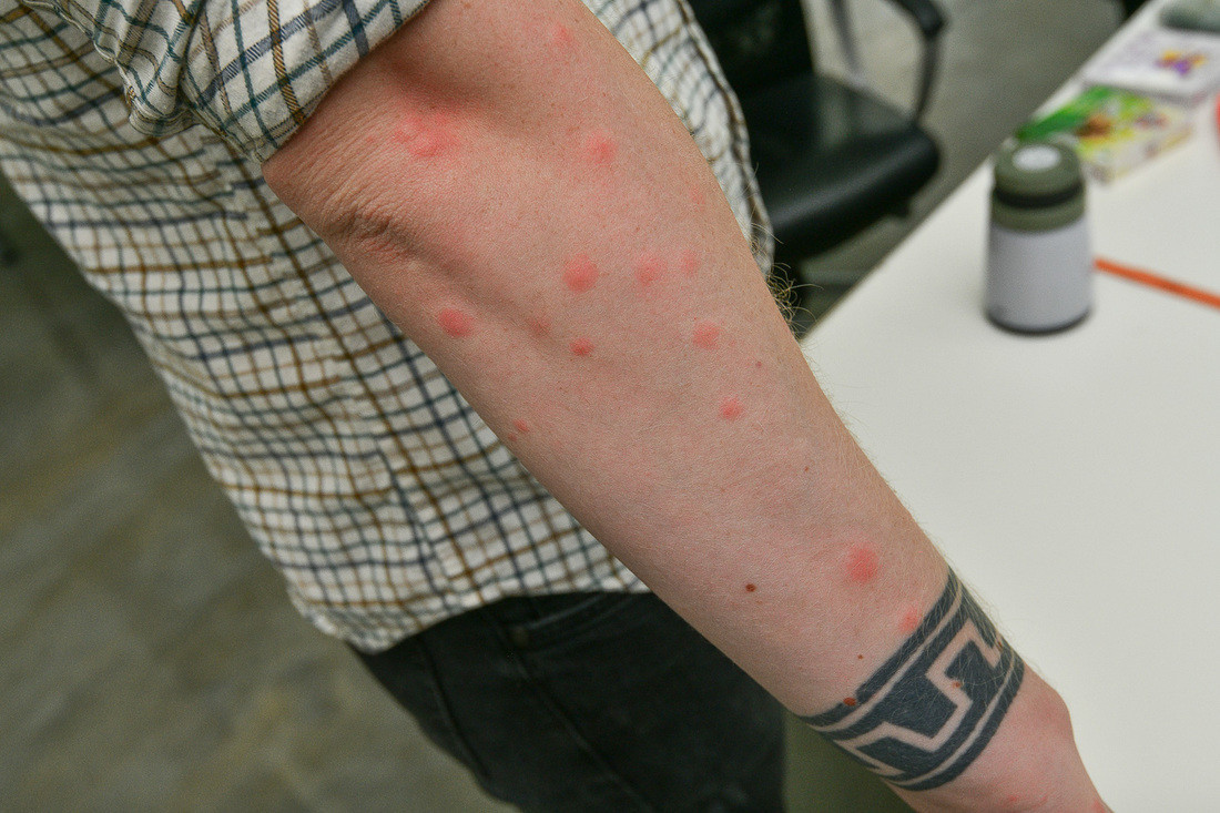 Наших старых добрых белорусских комаров как-то не принято считать разносчиками всякой опасной заразы.